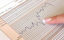 Фото: Фазы базальной температуры